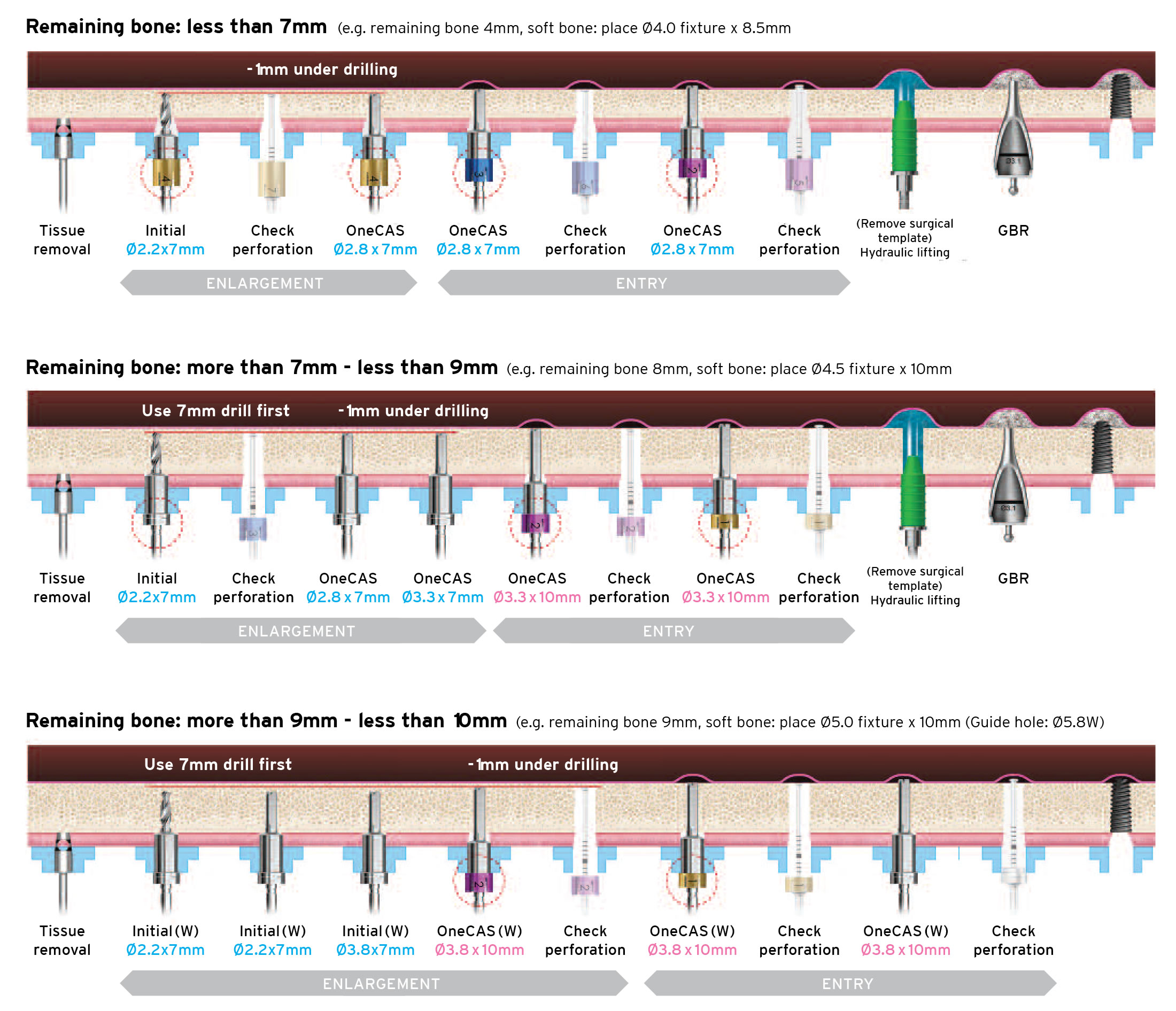 OneCAS KIT Remaining Bone