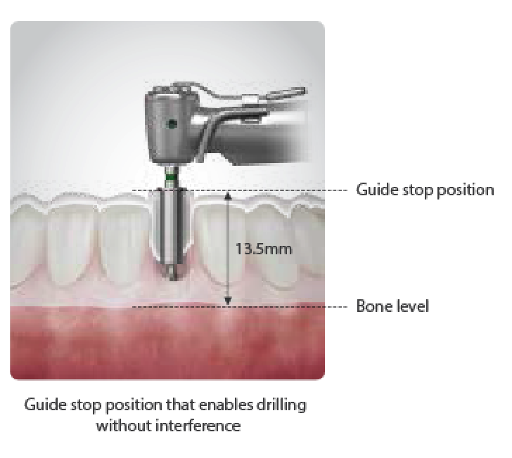 OneMS KIT Guided Surgery 2