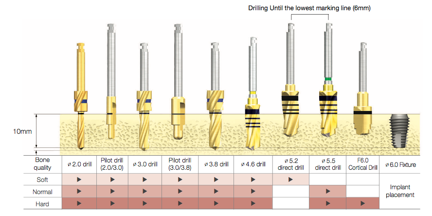 Drill Sequence for TSIII Ultra-Wide Fixture 01